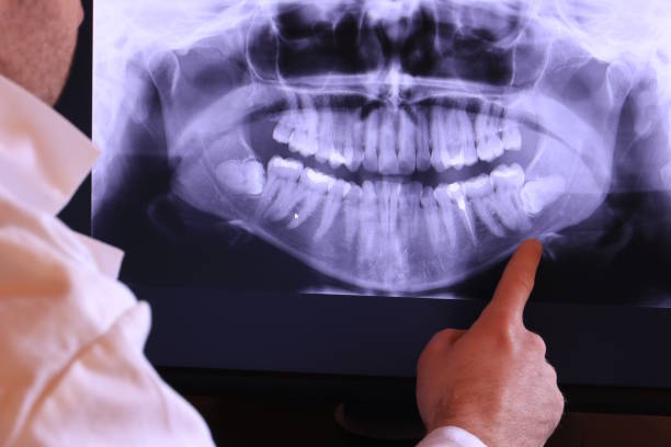 Best Emergency Treatment for Oral Infections in Melbourne, AR